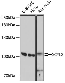 SCYL2 Rabbit Polyclonal Antibody
