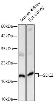 SDC2 Rabbit Polyclonal Antibody