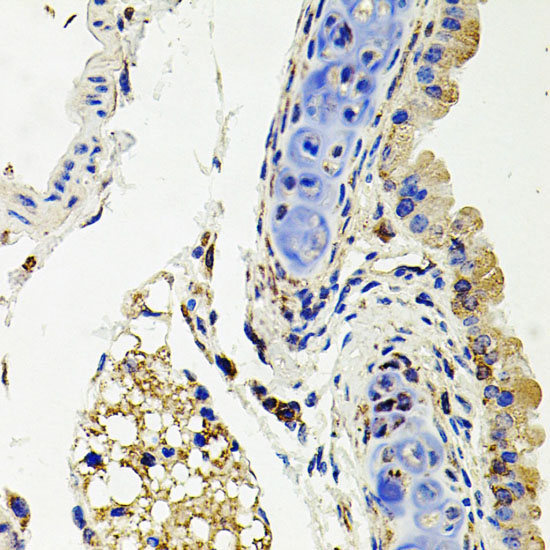 SDC2 Rabbit Polyclonal Antibody - Image 2