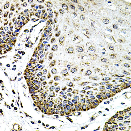 SDC2 Rabbit Polyclonal Antibody - Image 4