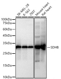 SDHB Rabbit Monoclonal Antibody