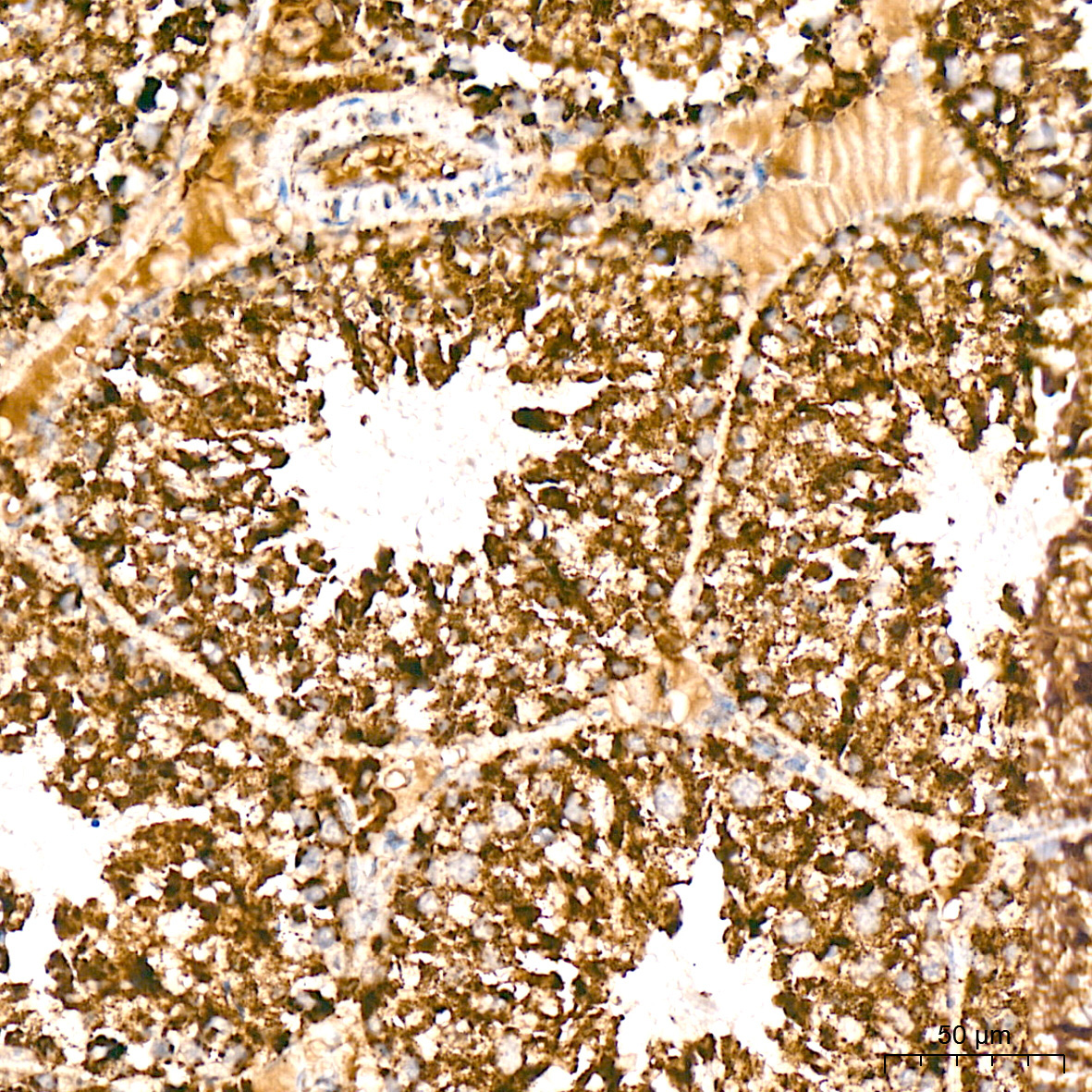 SDHB Rabbit Monoclonal Antibody - Image 3