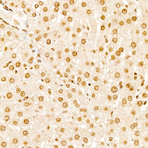 SEC14L2 Rabbit Polyclonal Antibody