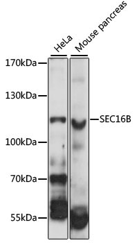 SEC16B Rabbit Polyclonal Antibody