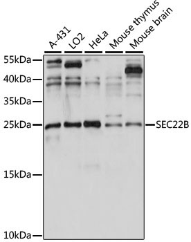 SEC22B Rabbit Polyclonal Antibody