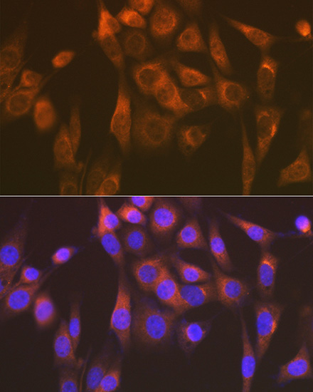 Sec23A Rabbit Monoclonal Antibody - Image 2