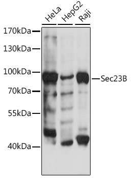 Sec23B Rabbit Polyclonal Antibody