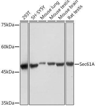 Sec61A Rabbit Monoclonal Antibody