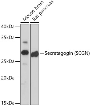 Secretagogin (SCGN) Rabbit Monoclonal Antibody