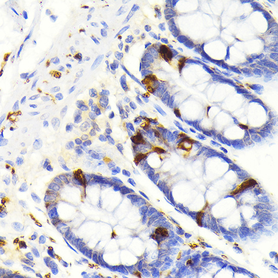 Secretagogin (SCGN) Rabbit Monoclonal Antibody - Image 2