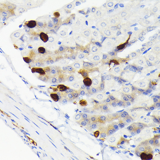 Secretagogin (SCGN) Rabbit Monoclonal Antibody - Image 3