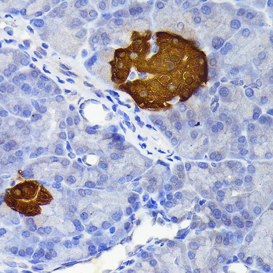 Secretagogin (SCGN) Rabbit Monoclonal Antibody - Image 4