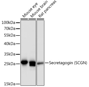 Secretagogin (SCGN) Rabbit Polyclonal Antibody