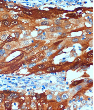 Secretagogin (SCGN) Rabbit Polyclonal Antibody - Image 2