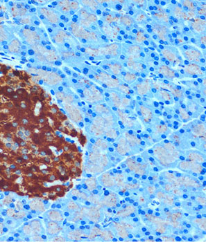 Secretagogin (SCGN) Rabbit Polyclonal Antibody - Image 3