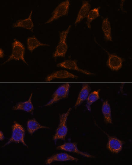 Secretagogin (SCGN) Rabbit Polyclonal Antibody - Image 4