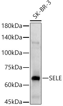 SELE Rabbit Polyclonal Antibody