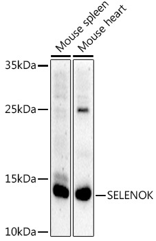 SELENOK Rabbit Polyclonal Antibody
