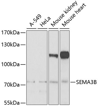 SEMA3B Rabbit Polyclonal Antibody