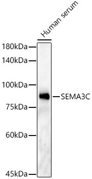 SEMA3C Rabbit Polyclonal Antibody
