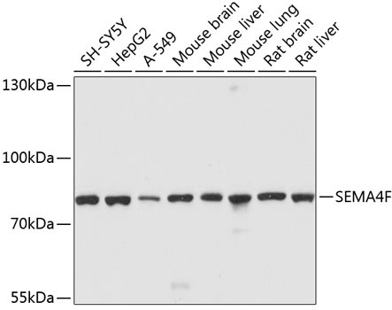SEMA4F Rabbit Polyclonal Antibody