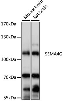SEMA4G Rabbit Polyclonal Antibody
