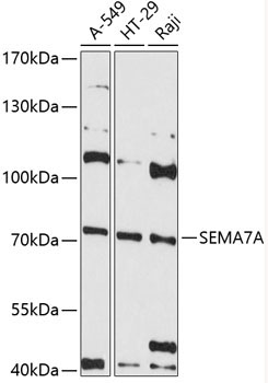 SEMA7A Rabbit Polyclonal Antibody