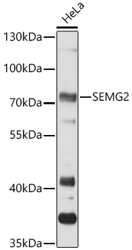 SEMG2 Rabbit Polyclonal Antibody