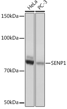 SENP1 Rabbit Monoclonal Antibody