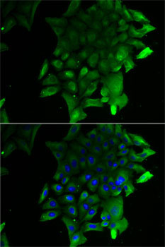 SEPSECS Rabbit Polyclonal Antibody - Image 2