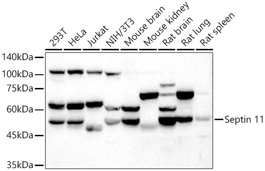 Septin 11 Rabbit Polyclonal Antibody
