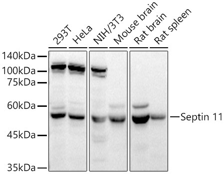 Septin 11 Rabbit Polyclonal Antibody