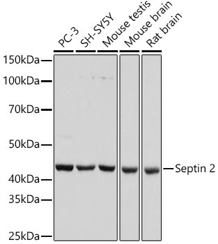 Septin 2 Rabbit Monoclonal Antibody