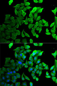Septin 2 Rabbit Polyclonal Antibody - Image 2