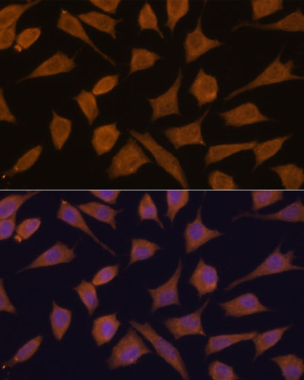 Septin 3 Rabbit Polyclonal Antibody - Image 2
