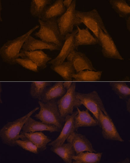Septin 3 Rabbit Polyclonal Antibody - Image 3