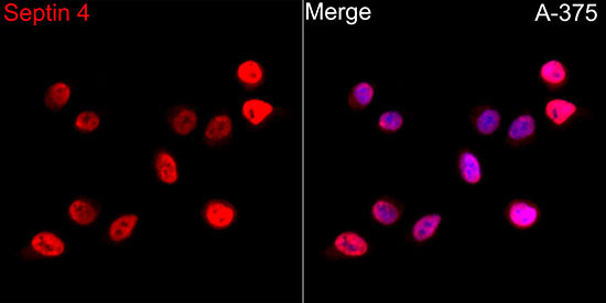 Septin 4 Rabbit Polyclonal Antibody - Image 2
