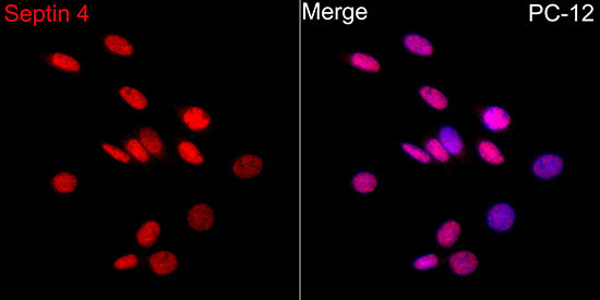 Septin 4 Rabbit Polyclonal Antibody - Image 3