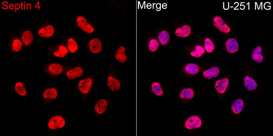 Septin 4 Rabbit Polyclonal Antibody - Image 4