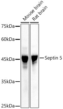 Septin 5 Rabbit Polyclonal Antibody
