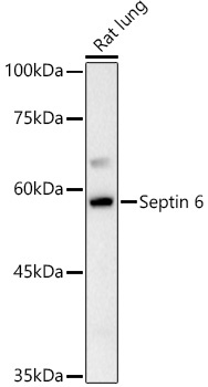 Septin 6 Rabbit Polyclonal Antibody