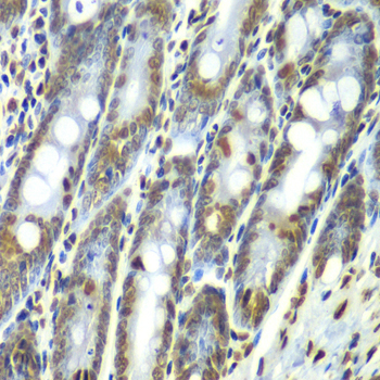 Septin 7 Rabbit Polyclonal Antibody - Image 2