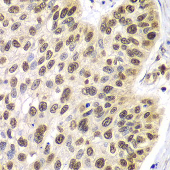 Septin 7 Rabbit Polyclonal Antibody - Image 3