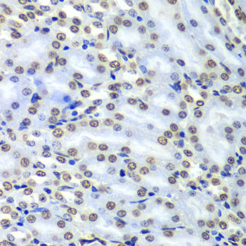 Septin 7 Rabbit Polyclonal Antibody - Image 4