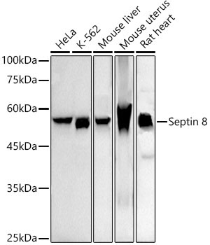 Septin 8 Rabbit Monoclonal Antibody