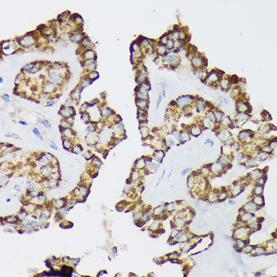 Septin 8 Rabbit Polyclonal Antibody - Image 2