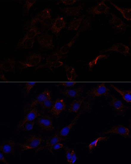 Septin 8 Rabbit Polyclonal Antibody - Image 3