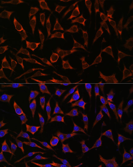 Septin 8 Rabbit Polyclonal Antibody - Image 4