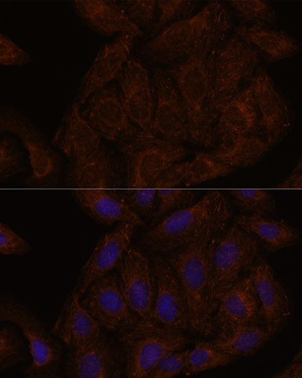 Septin 8 Rabbit Polyclonal Antibody - Image 5