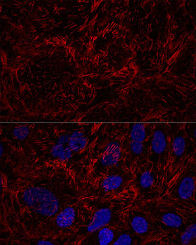Septin 9 Rabbit Polyclonal Antibody - Image 2